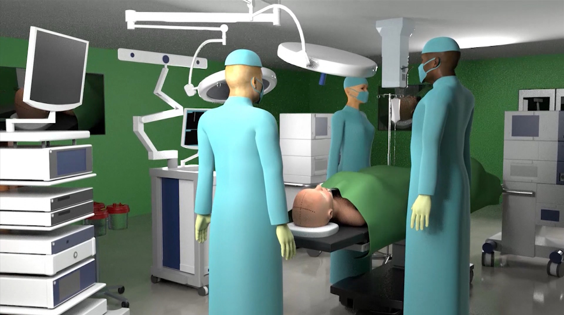 Endoscopic Third Ventriculostomy surgical animation — AIIMS Delhi